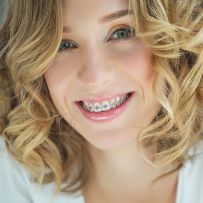 Mansfield Family Dentistry | Extractions, Crowns and Dental Bonding